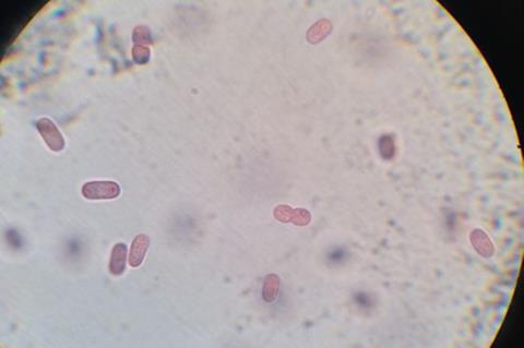 Chromatium_Okenii_al_microscopio