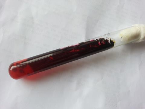 Ochroconis_gallopava_growth_on_SDA_after_4_days_of_incubation_showing_red_to_maroon_pigment_around_the_colony