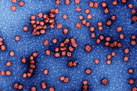 Hepatitis_b (2)