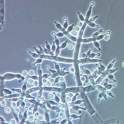 Trichoderma_harzianum