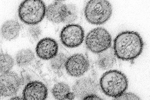 Sin_Nombre_virus_Hanta_TEM_1137_lores