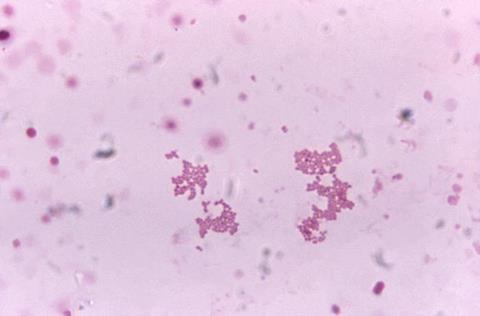 Veillonella_spp._under_1125X_magnification