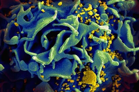 HIV-infected_T_cell_(6813489183)