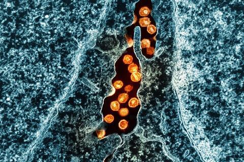 HIV_Virus_Particles_-_2