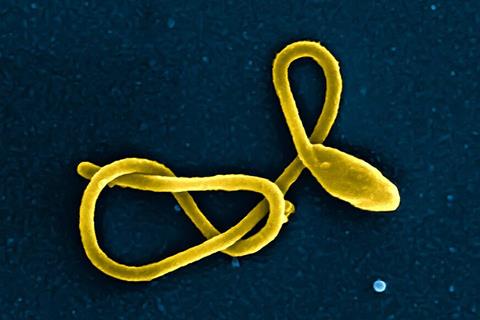 Ebola_Virus_Particle_(43492898261)