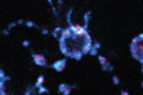 HCR-FISH_image_of_a_Heimdallarchaeia_cell
