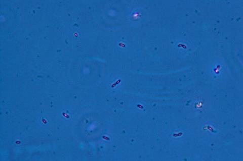 Geobacter_sulfurreducens.TIF