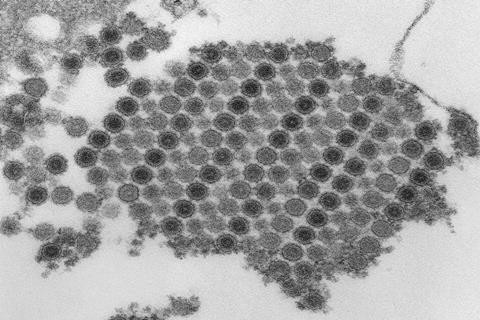 Chikungunya_virus_particles-PHIL-17369 (2)