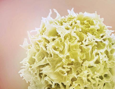 T_Lymphocyte,_also_known_as_a_T_cell_(yellow_color) (1)