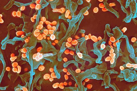 Lassa_virus_budding_off_a_Vero_cell