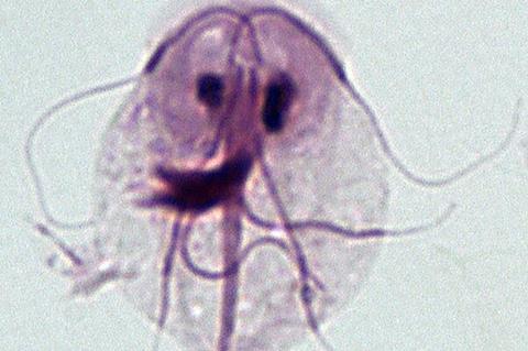 Giardia_intestinalis_-_trophozoite
