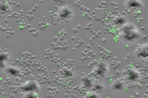 Low-Res_Mycobacterium tuberculosis (green) inside human immune cells known as macrophages