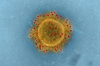 Middle_East_Respiratory_Syndrome_Coronavirus_particle_envelope_proteins_immunolabeled