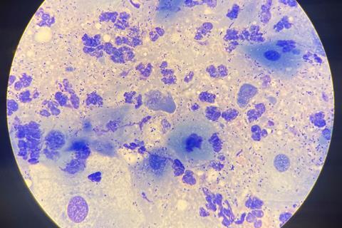 Chlamydia-22Feb25