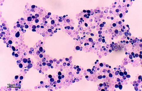 Candida_albicans_(248_35)