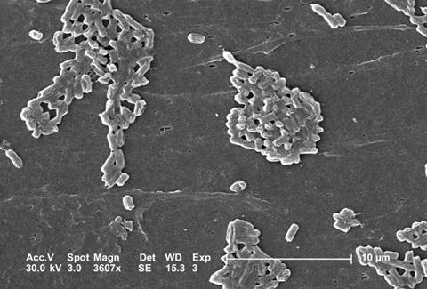 Esch_coli