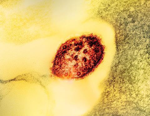 Measles_Virus_Particle