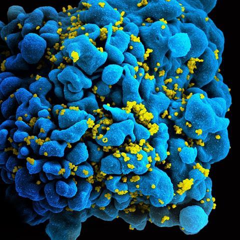 HIV-infected_T_cell_(6813384933)