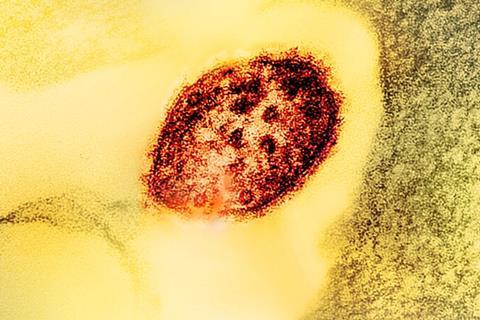 Measles_Virus_Particle (1)