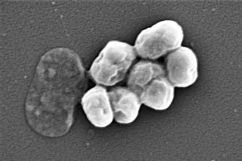 A.baumannii_visualized_using_Scanning_electron_microscopy