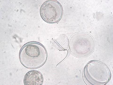 Coscinodiscus_granii