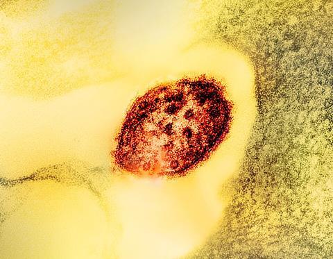 Measles_Virus_Particle