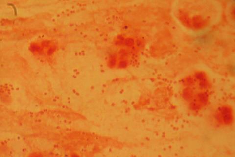 Haemophilus_influenzae_Gram