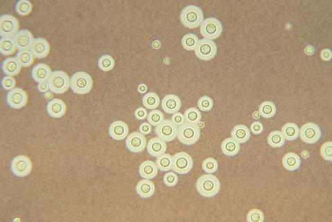 Cryptococcus_neoformans_using_a_light_India_ink_staining_preparation_PHIL_3771_lores (1)