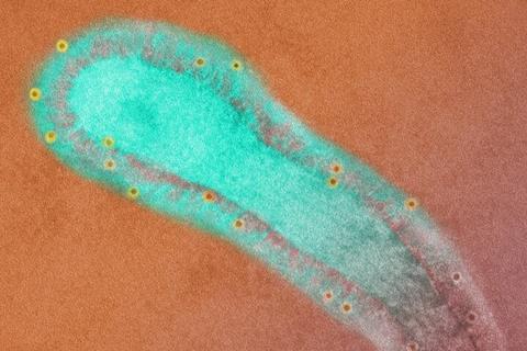 Human_Respiratory_Syncytial_Virus_(RSV)_(52453014952)