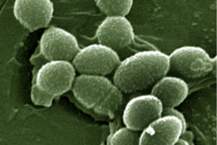 Enterococcus_faecalis_SEM_01_Detail