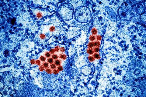 Dengue_Virus_Particles_(53232295844) (1)