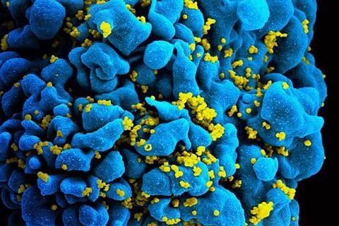 HIV-infected_T_cell_(6813384933)