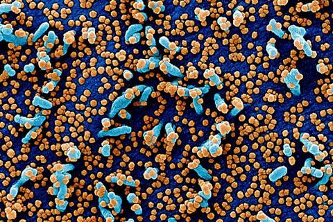 Novel_Coronavirus_SARS-CoV-2_(49680384436)