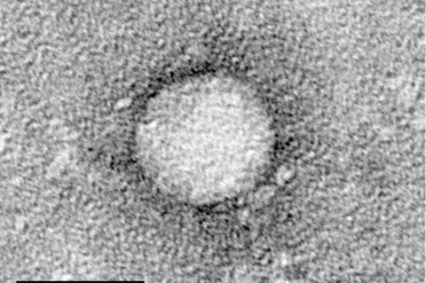 HCV_EM_picture_2
