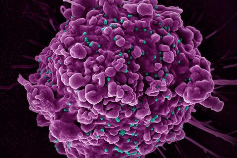 HIV_Virus_-_5412 (1)