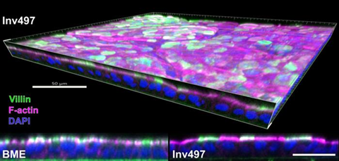 Low-Res_Apical_basal_Invasin