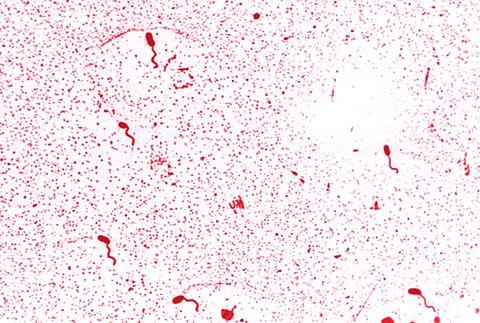 Vibrio_cholerae_01