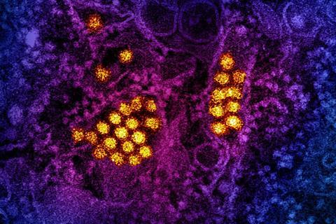 Dengue_Virus_Particles_(53231044882)