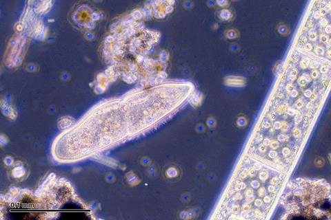 960px-Paramecium_caudatum_(248_06)_Native_preparation