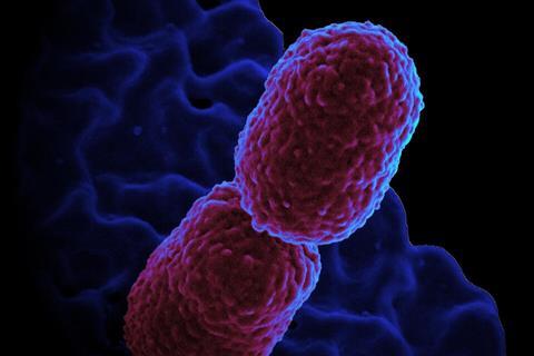 Klebsiella_pneumoniae_Bacterium_(13383468143) (1)