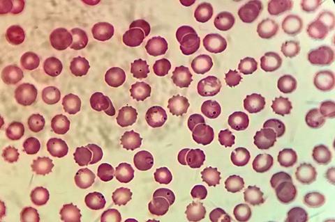 800px-Plasmodium_in_erythrocytic_cycle