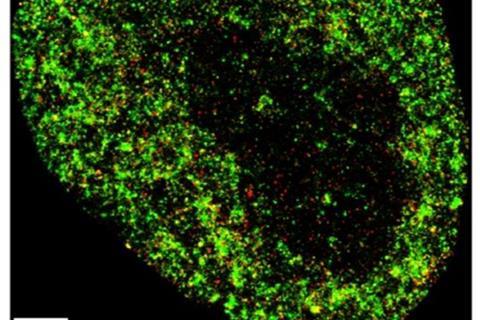 Low-Res_HeLA cancer cell in superresolution (1)