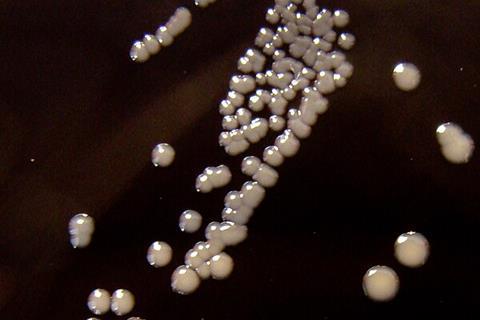 Bordetella_pertussis_on_Charcoal_Agar_supplemented_with_Cephalexin_-_Detail (1)