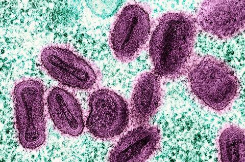 Mpox_Virus_-_53848418728