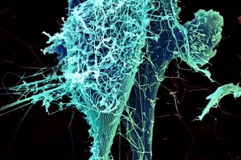 String-like_Ebola_virus_peeling_off_an_infected_cell_(20690217151)