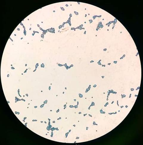 Saccharomyces_cerevisiae