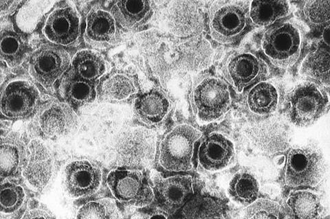 Herpes_simplex_virions,_TEM