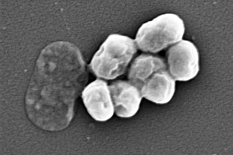 960px-A.baumannii_visualized_using_Scanning_electron_microscopy