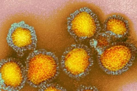 Colorful_photo_of_influenza_particles.webp