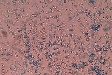 Malassezia_in_LPCB_Tease_Mount_Microscopy (1)